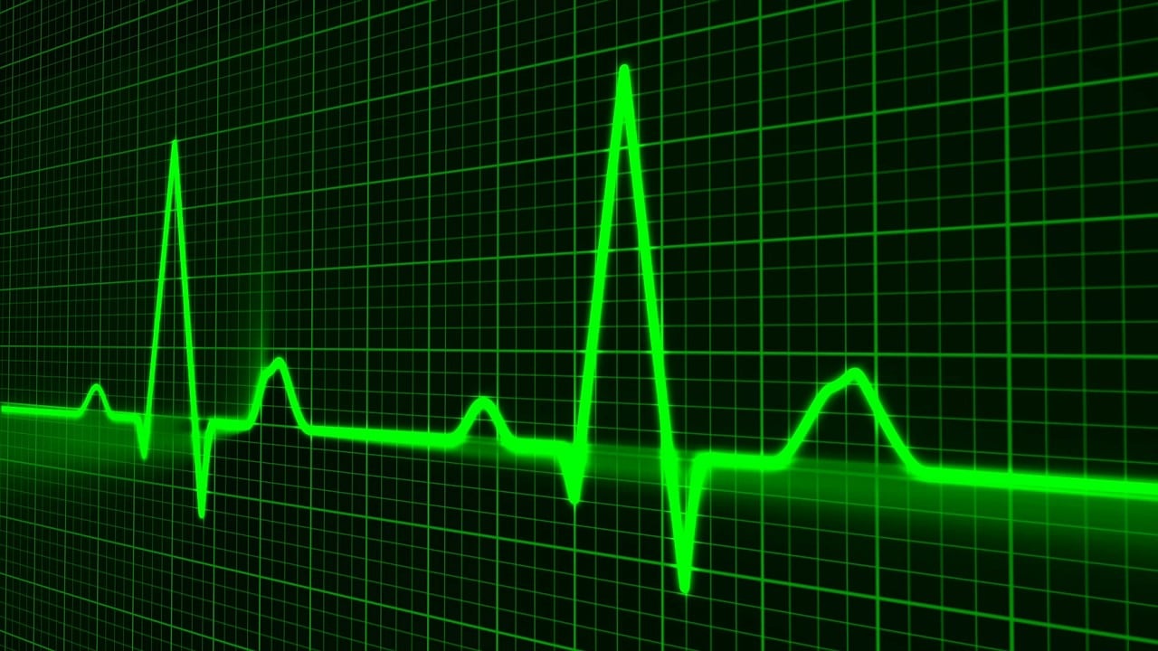 pulse trace, healthcare medicine, heartbeat, heart shape, medical equipment, equipment, symbol, graph, medical technical equipment, pulsating, medical supplies, wave pattern, computer graphic, monitoring equipment, heart beating, nobody, green computer, green heart, green laptop, green medical, green medicine, green pattern, green wave, green healthcare, green waves, green technical, heartbeat, heartbeat, heartbeat, heartbeat, graph, graph, graph, graph, graph